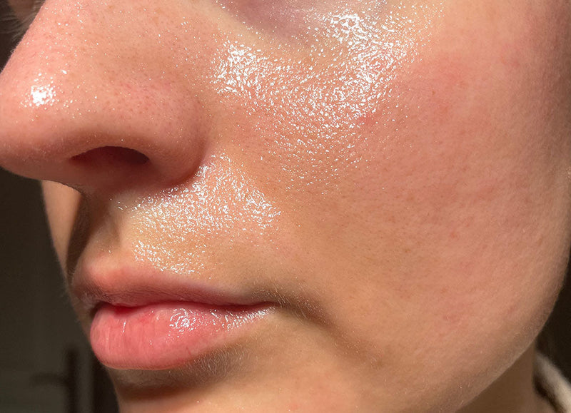Skincare Routine for Oily Skin
