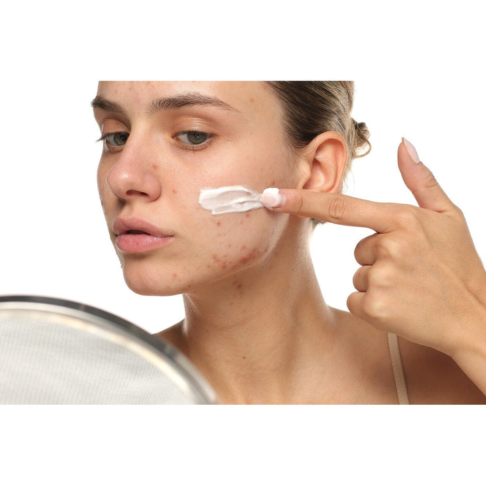 Acne: Types, Causes, Treatment & Prevention