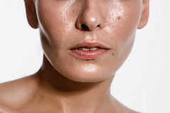 Should I Moisturize Oily Skin?