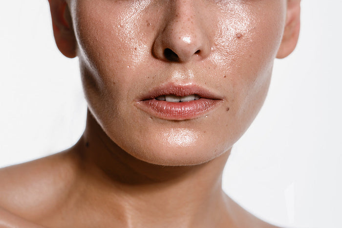 Should I Moisturize Oily Skin?