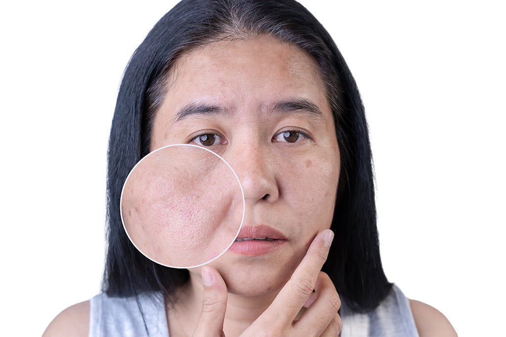 Skincare Routine for Combination Skin