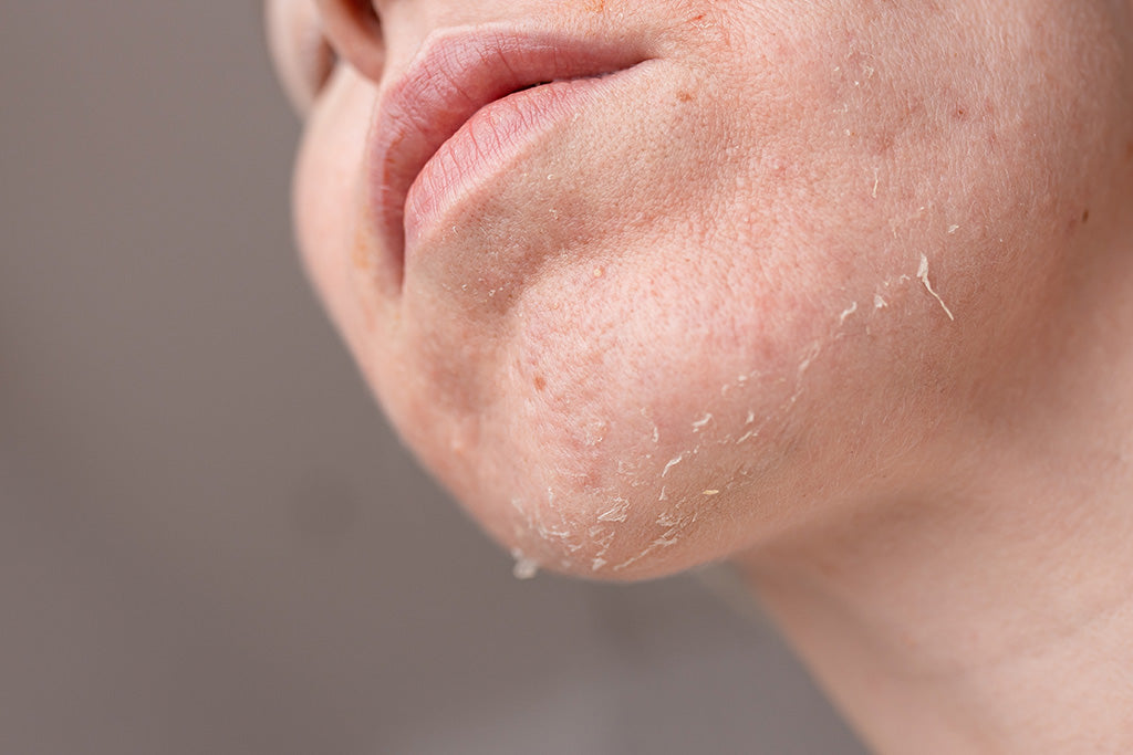 Skincare Routine for Dry Skin