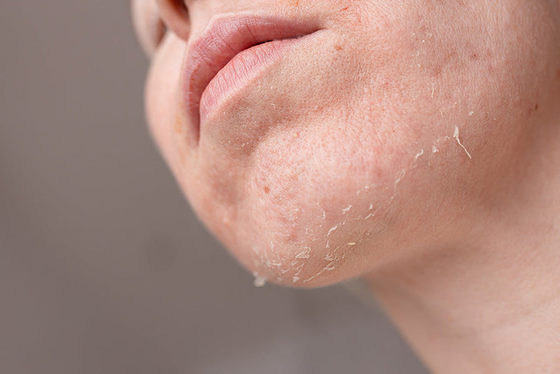Skincare Routine for Dry Skin