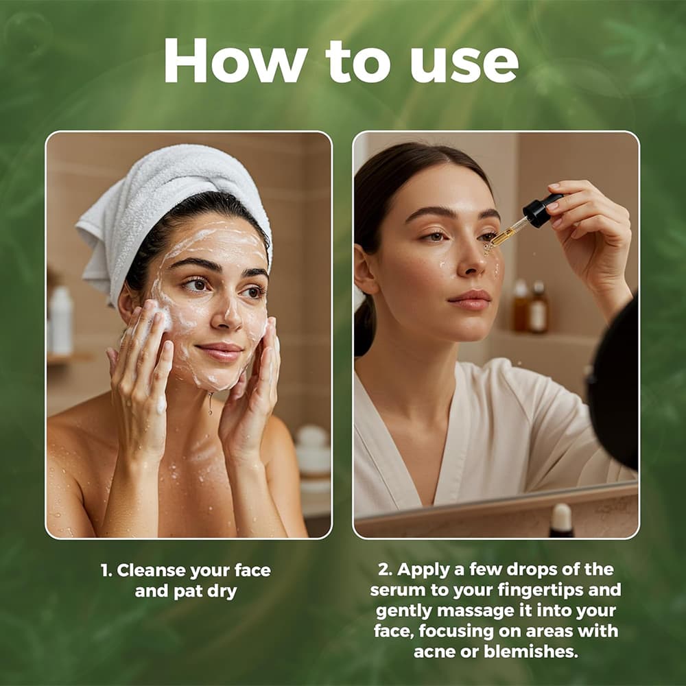 Plant-based anti-acne serum for clear skin – By Nature 50ml