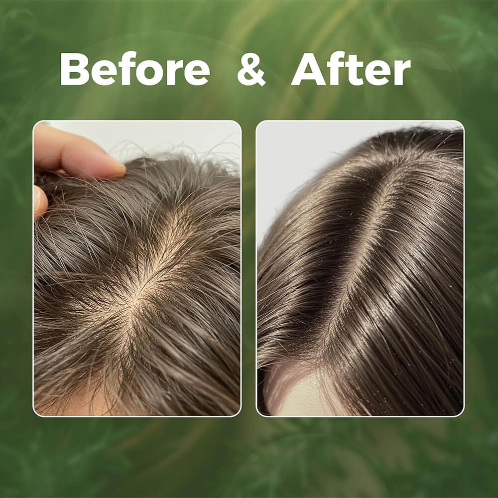 ByNature scalp repair serum for dandruff, itch, and dryness