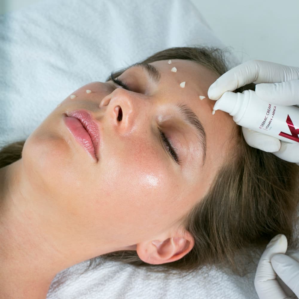 K Dermic soothing cream for laser, peel, and dermatological care