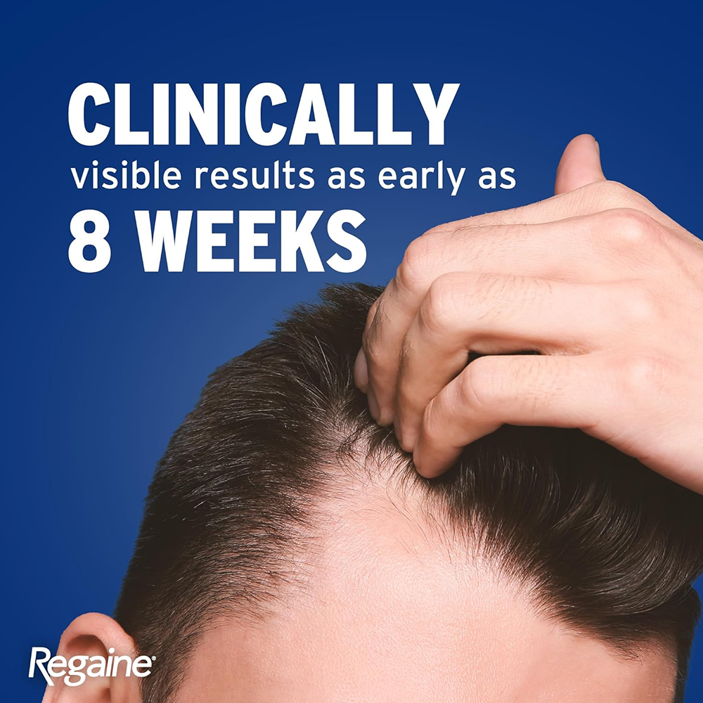 REGAINE FOR MEN 5% 60ML, Hair Loss Treatments